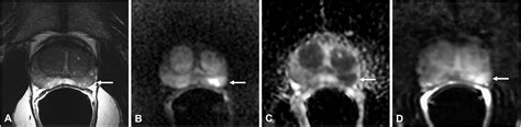 Frontiers Multiparametric Magnetic Resonance Imaging For The