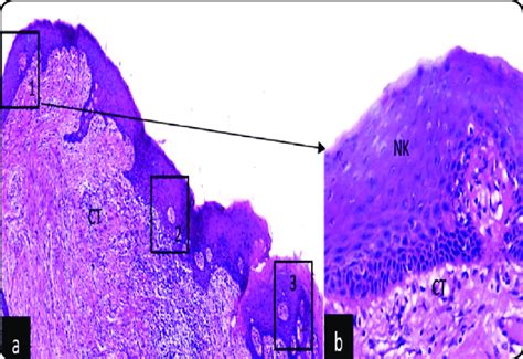 Light Micrograph Of The Excised Tissues A Low Power Of The Excised