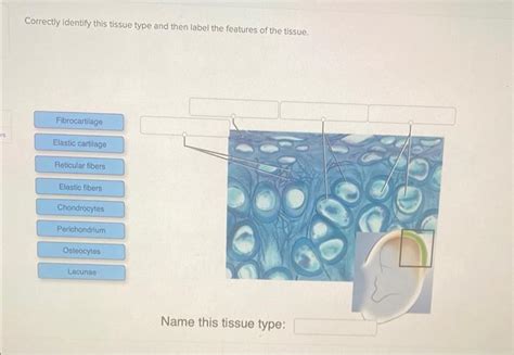 Solved Correctly Identify This Tissue Type And Then Label Chegg