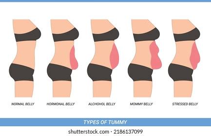 Illustration Types Tummies Woman Body Type Stock Vector (Royalty Free ...