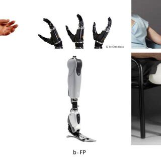 a. Above: Realistic prosthetic limb for upper limb loss made of ...