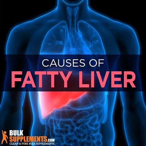 Fatty Liver Disease. Get the Supplements You Need.