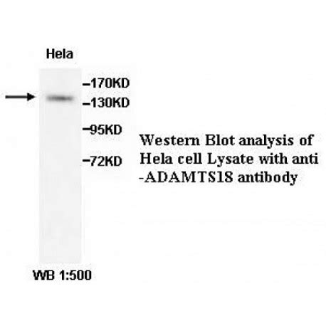 ADAMTS18 Antibody Supplier CAS AOBIOUS