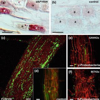 1 In situ hybridization techniques for gene expression analysis and ...