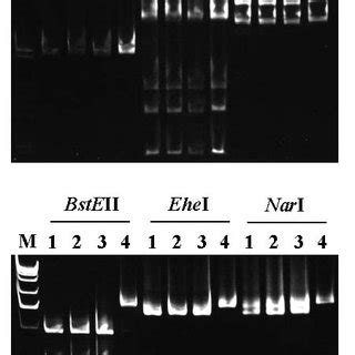 Polyacrylamide Gels Showing Rflp Patterns Of The S Rrna Gene Plus