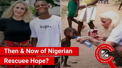 FACT CHECK Viral Photos Show Then Now Of Nigerian Boy Hope Rescued