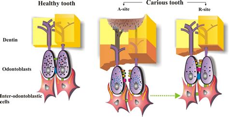 Use Vitamin k2 to Remineralize Your Teeth | Vitamin k2, Vitamins ...