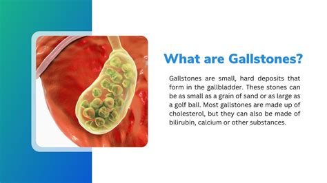 Ppt Get Relief From Your Gallstone With The Gallbladder Surgery In Amritsar Powerpoint