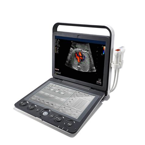 Sonoscape S Medical Ultrasound Ultrasonic Instruments Portable Color