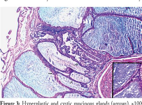 Figure 3 From Pathomorphological And Immunohistochemical Findings Of