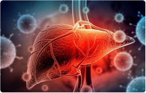 Mengenal Jenis Hepatitis Dan Penanggulangannya Suarabaru Id