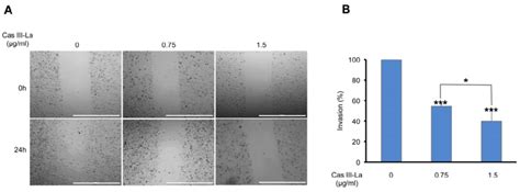 Cas III-La inhibits cell migration and invasion in glioma cells. (A ... 