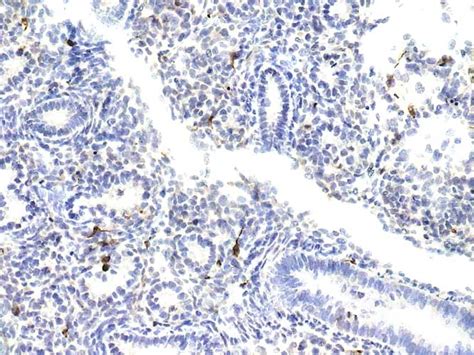 Phospho 4E BP1 Thr37 46 In Rat D17 Embryo FFPWS Using Cell