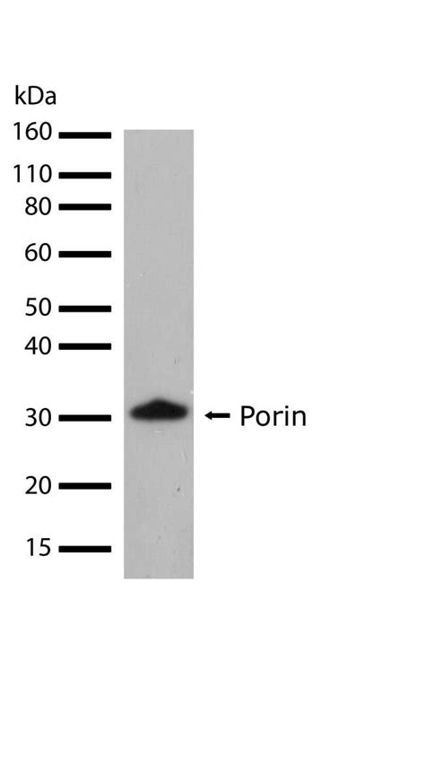 Vdac Recombinant Polyclonal Antibody 17hclc Invitrogen 100 μg