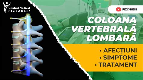 Coloana Vertebral Lombar Centrul Medical Fiziorein Youtube