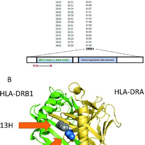 HLA DRB1 Genotype Frequency In The AIH Patients And Controls