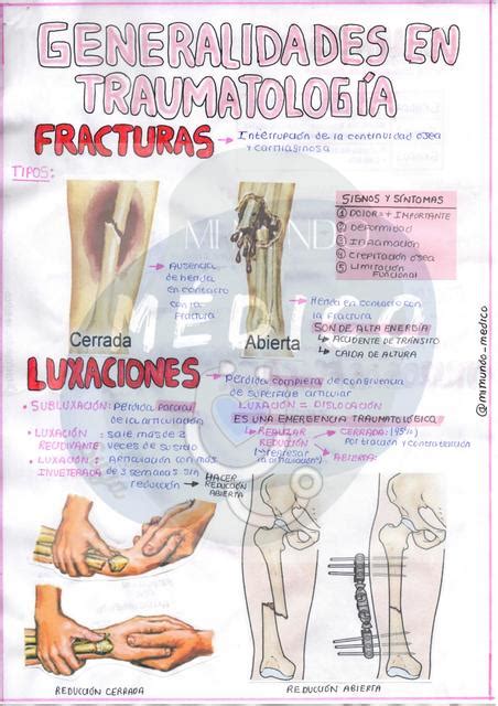 GENERALIDADES EN TRAUMATOLOGÍA Apuntes de medicina Tipos de