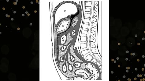 Radiographie de lAbdomen Sans Préparation introduction partie 01