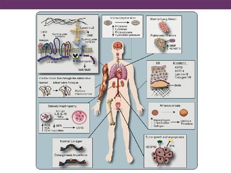 Understanding And Exploiting The Tumor Microenvironment In Glioblastoma