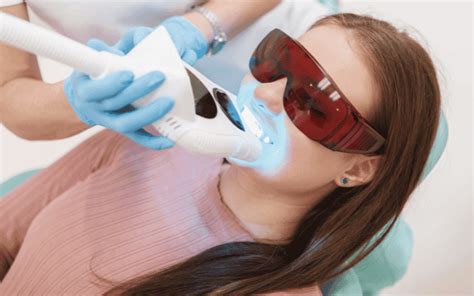 Pros And Cons Of Laser Teeth Whitening Excel Dental