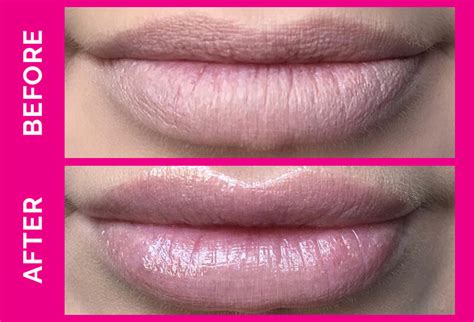 Smashbox Lip Plumper Before And After Shop | dakora.com.co