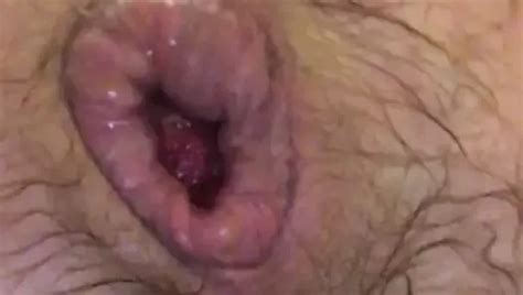 Defonce Au Gode Gay Gaping Amateur Porn Feat Salope42 XHamster