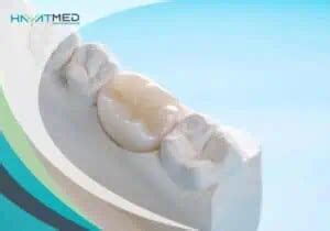 Zirconia Crown Vs Porcelain Differences And Price