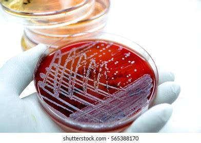 White Bacteria Beta Hemolysis Colonies On Stock Photo 565388170 ...