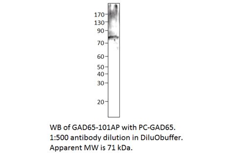 Anti Gad65 Antibody A54677