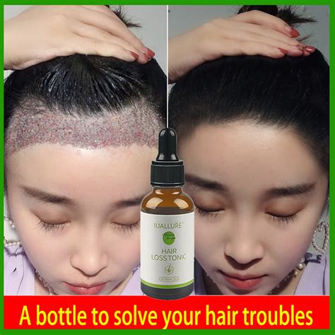 Jual Penumbuh Rambut Botak Serum Penumbuh Rambut Hair Growth Serum 30ml