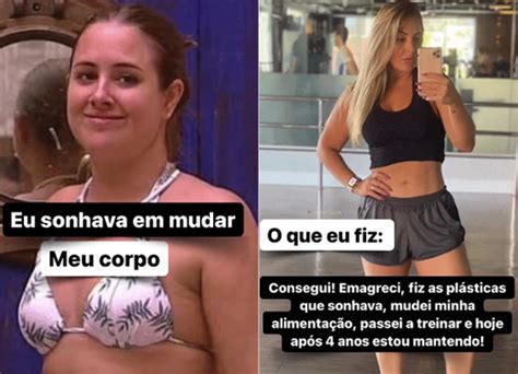 Midianews Ex Bbb Patr Cia Leitte Mostra Antes E Depois De Corpo