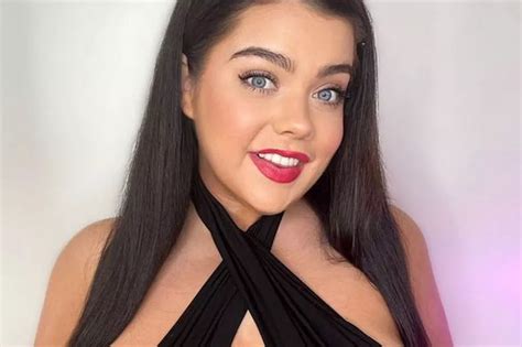 Onlyfans Model With One H Cup Boob And Another Half The Size Turned Down Surgery As People Get