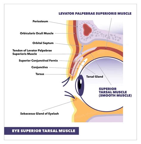 Levator Palpebrae Superioris Cadaver