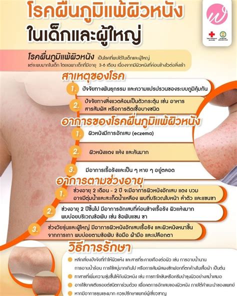 Bettercm Dermatitis