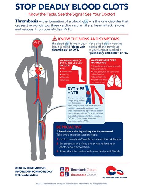 Thrombosis Canada