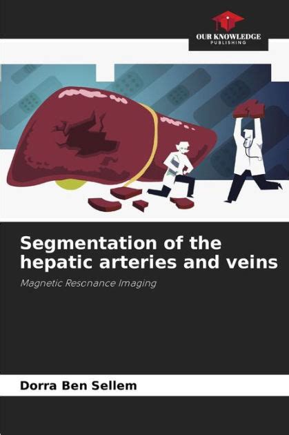 Segmentation Of The Hepatic Arteries And Veins By Dorra Ben Sellem