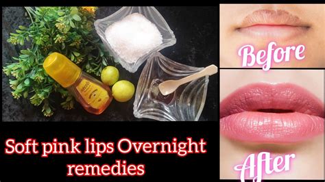 Get Soft Pink Lips Overnight Remedy DIY Lip Stain Easiest Lip Care It