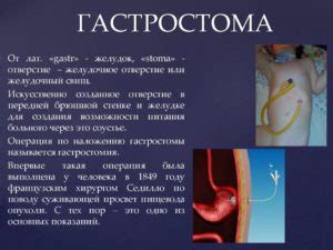 Гастростомия показания. Наложение гастростомы (гастростомия): показания ...