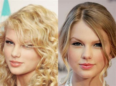 Taylor Swift before and after plastic surgery 03 | Celebrity plastic ...