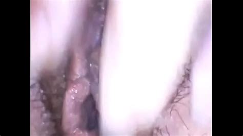 Exploring A Beautiful Hairy Pussy With Medical Endoscope Have Fun Xxx