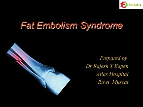 Fat Embolism Ppt