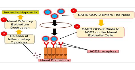 Proinflammatory Cytokines In The Olfactory Mucosa Result In COVID 19