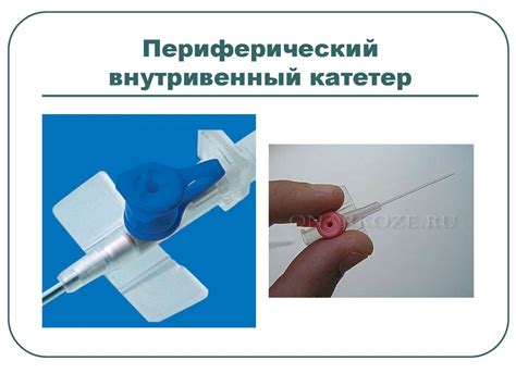 Периферический внутривенный катетер - презентация онлайн