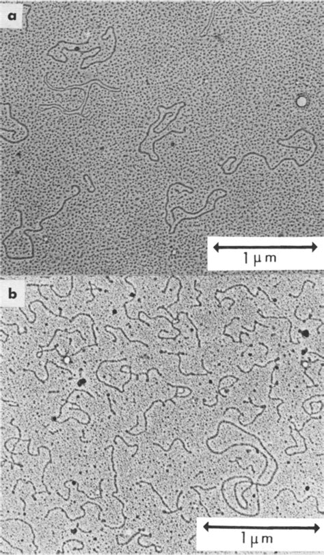 Histogram of the length distribution of tobacco mosaic virus RNA. The... | Download Scientific ...