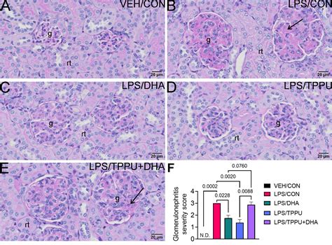 Frontiers Lipidome Modulation By Dietary Omega 3 Polyunsaturated