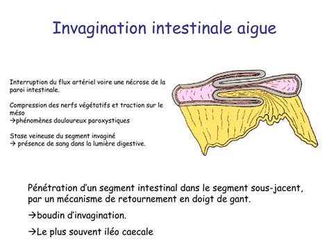 Ppt H Morragies Digestives Powerpoint Presentation Id