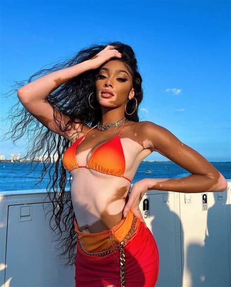 Winnie Harlow Spread Her Legs Wide In Tiny Bikini Photos The Fappening