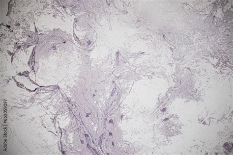 Motor Neuron, Spinal cord, Nerve fibres and nerve cells under the ...