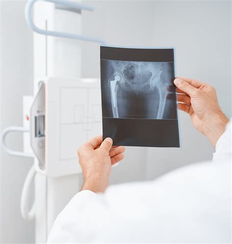 Dr. Praveens Ortho Clinic Home - Dr. Praveens Ortho Clinic