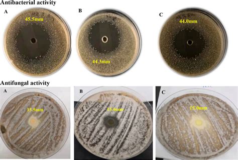 Inhibition Zones Of Tested Bacteria Staphylococcus Aureus And Fungal